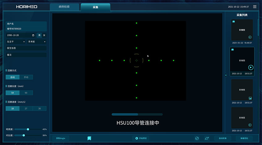 恒宇醫療OCT系統醫療影像軟件界面設計-藍藍設計